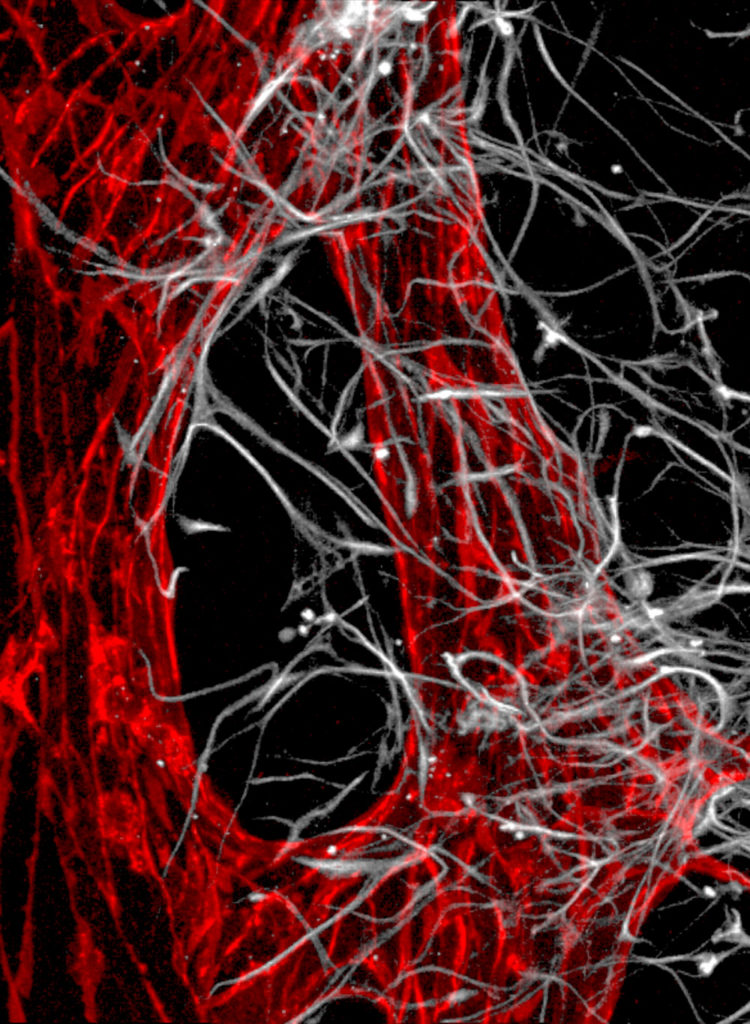 Vascular network-astrocytes interface