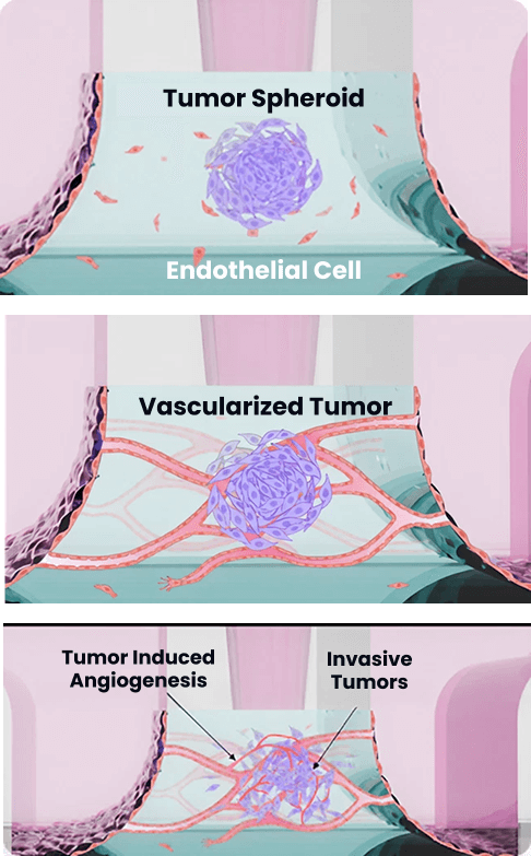 cancer-metastasis-img1 content-image