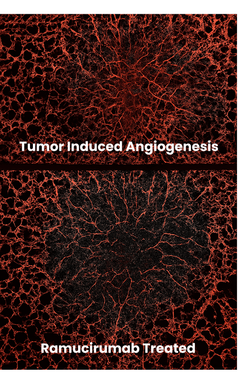 cancer-metastasis-img2 content-image