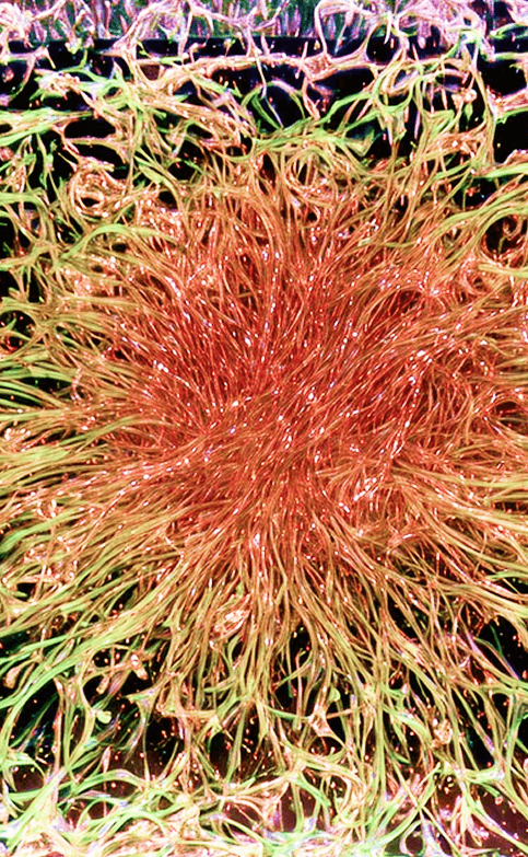 cancer-metastasis-img3 content-image